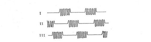 Exciting-current-of-three-groups-parametron.JPG